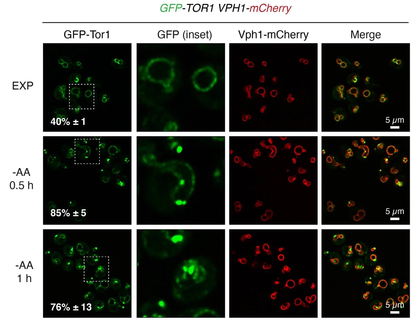 Open access visualization of Microscopy, Amino Acid Starvation, Tor1, Pib2-Positive Endosomes, WT Cells
