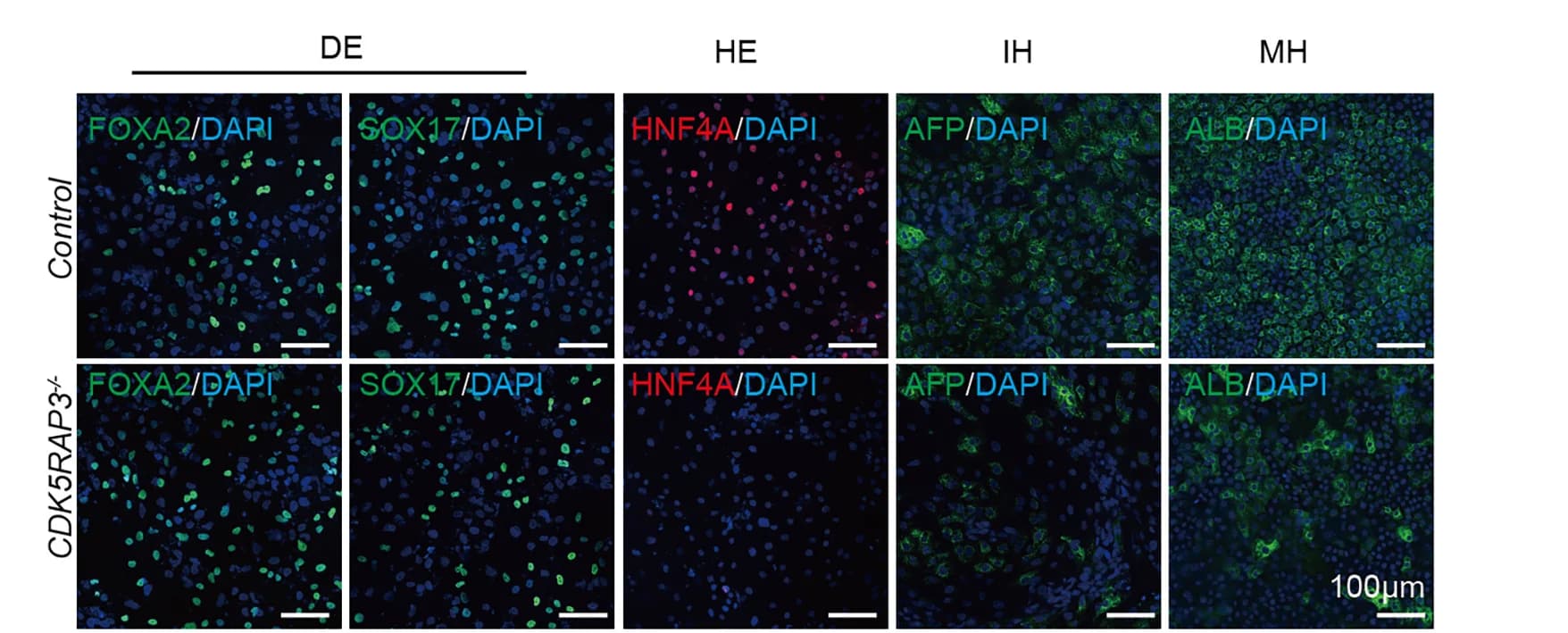 Open access visualization of Microscopy, Immunofluorescence Staining, Marker Gene Expression, Hepatocyte Differentiation, hESCs