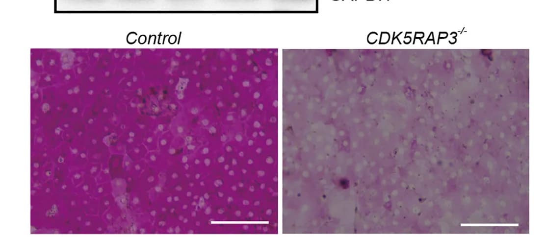 Open access visualization of Microscopy, Gel, Periodic Acid-Schiff Staining, HLCs, hESCs