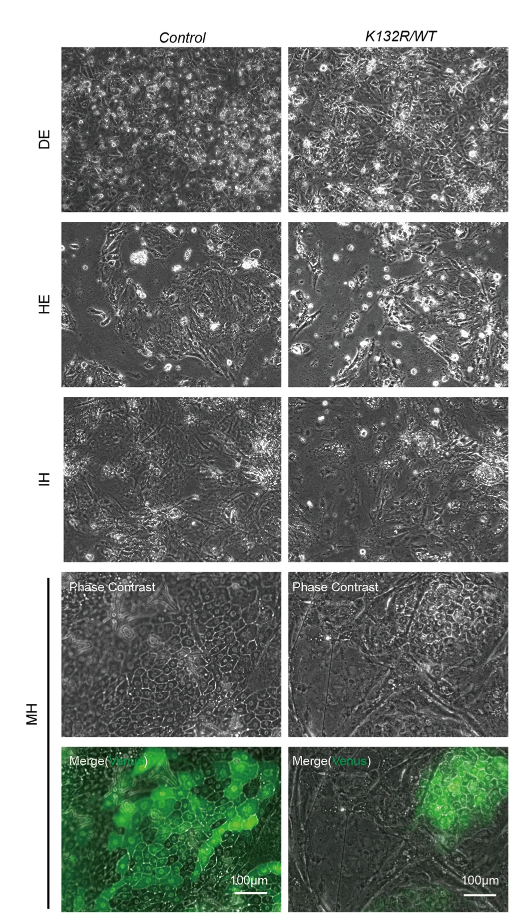 Open access visualization of Microscopy, Morphology, Venus Fluorescence, Hepatic Differentiation, Human Embryonic Stem Cells