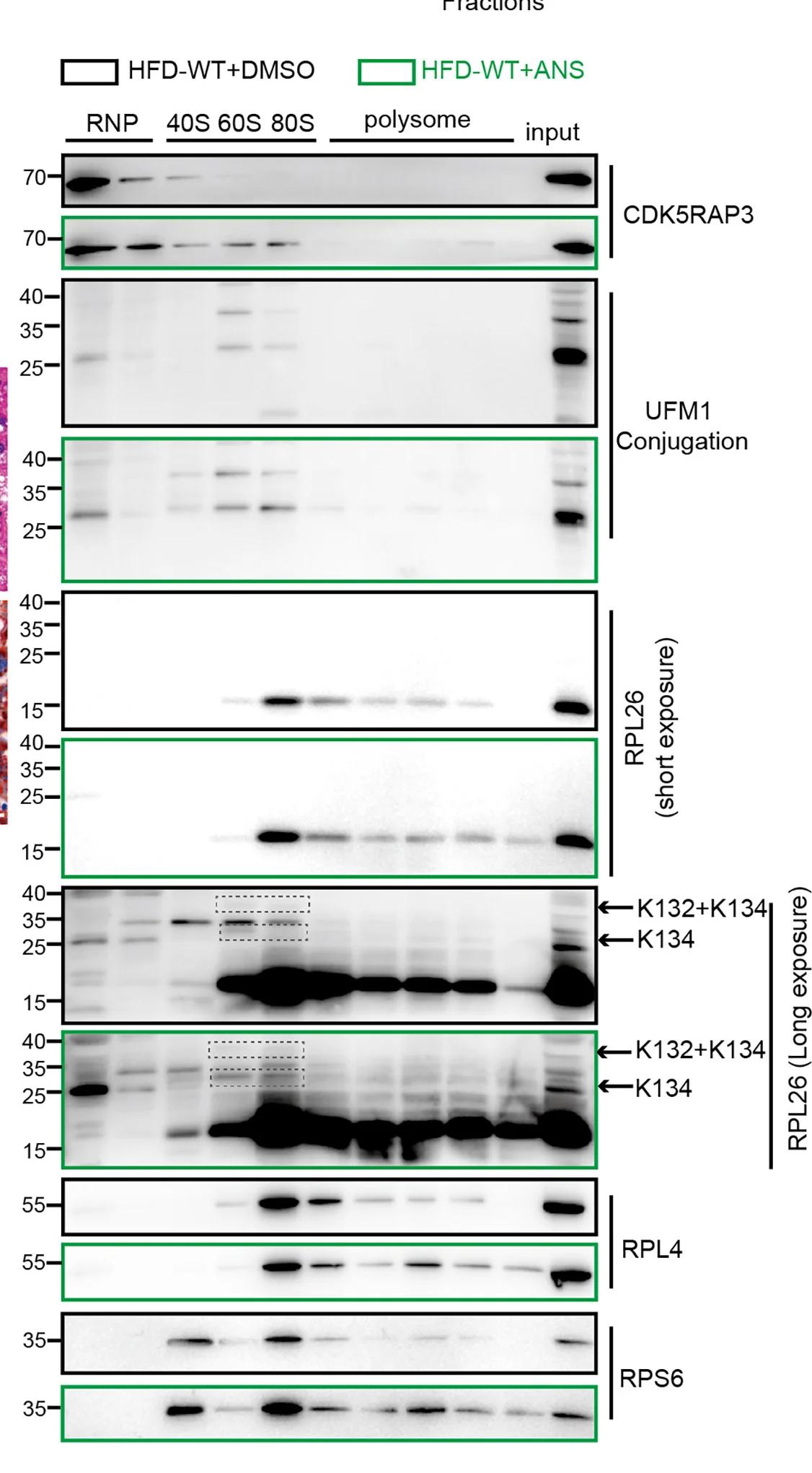 Open access visualization of Gel, Sucrose Gradients, Liver Lysates, Mice, HFD Feeding
