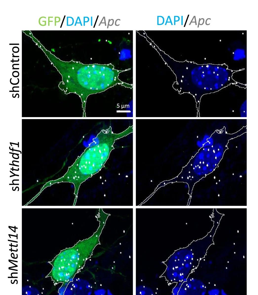 Open access visualization of Microscopy, Apc ViewRNA ISH, Neurons, shControl, shYthdf1