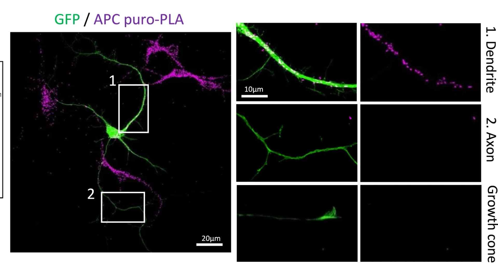 Open access visualization of Microscopy, APC puro-PLA Labeling, DIV6 Neuron, GFP, Primary Dendrite