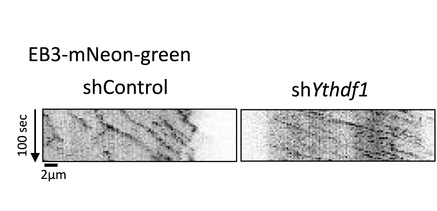 Open access visualization of Microscopy, Kymographs, Live Imaging, EB3-NeonGreen Comets, Growth Cone