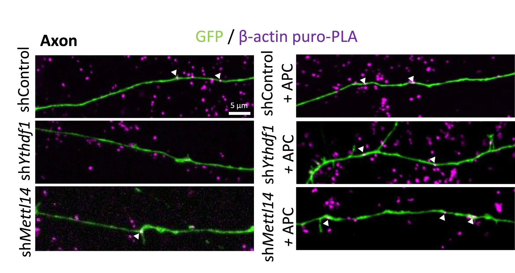 Open access visualization of Microscopy, Puro-PLA, Beta-Actin, Axons, Neurons