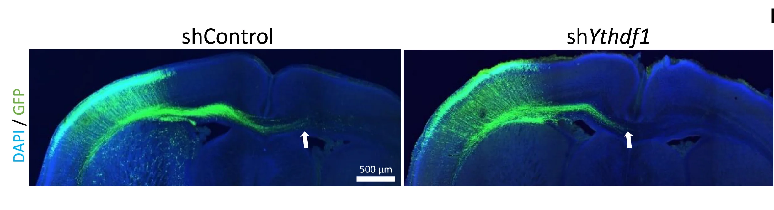 Open access visualization of Microscopy, Brain Slices, Electroporated Callosal Neurons, shControl, shYthdf1