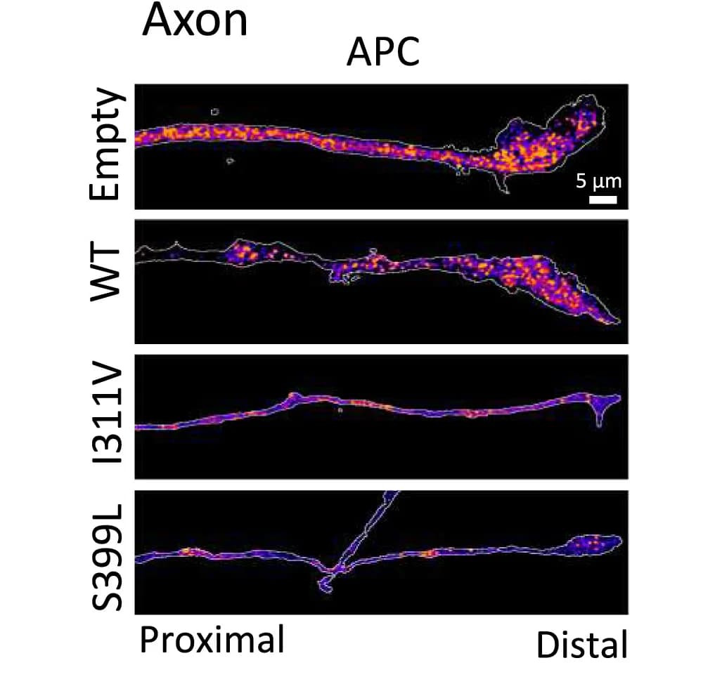 Open access visualization of Microscopy, Axonal Growth Cones, Neurons, Transfection, GFP-expressing plasmid