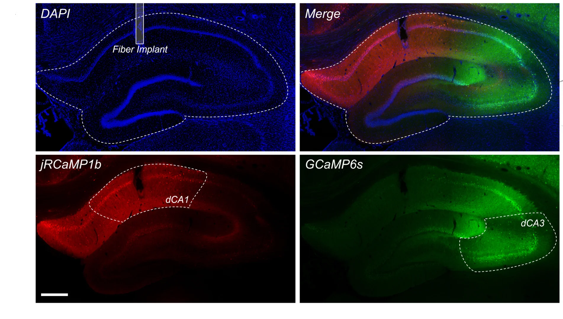Open access visualization of Microscopy, AAV9-CaMKII-GCaMP6s, AAV9-Syn-jRCaMP1b, CA3 Projections, CA1