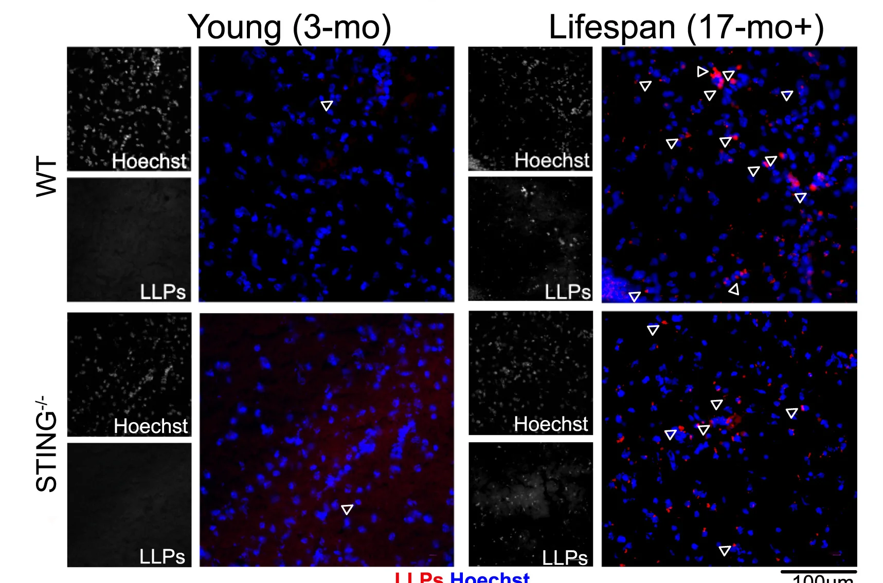Open access visualization of Microscopy, Immunofluorescence, Lipofuscin Like Particles, Hippocampus, Autofluorescence