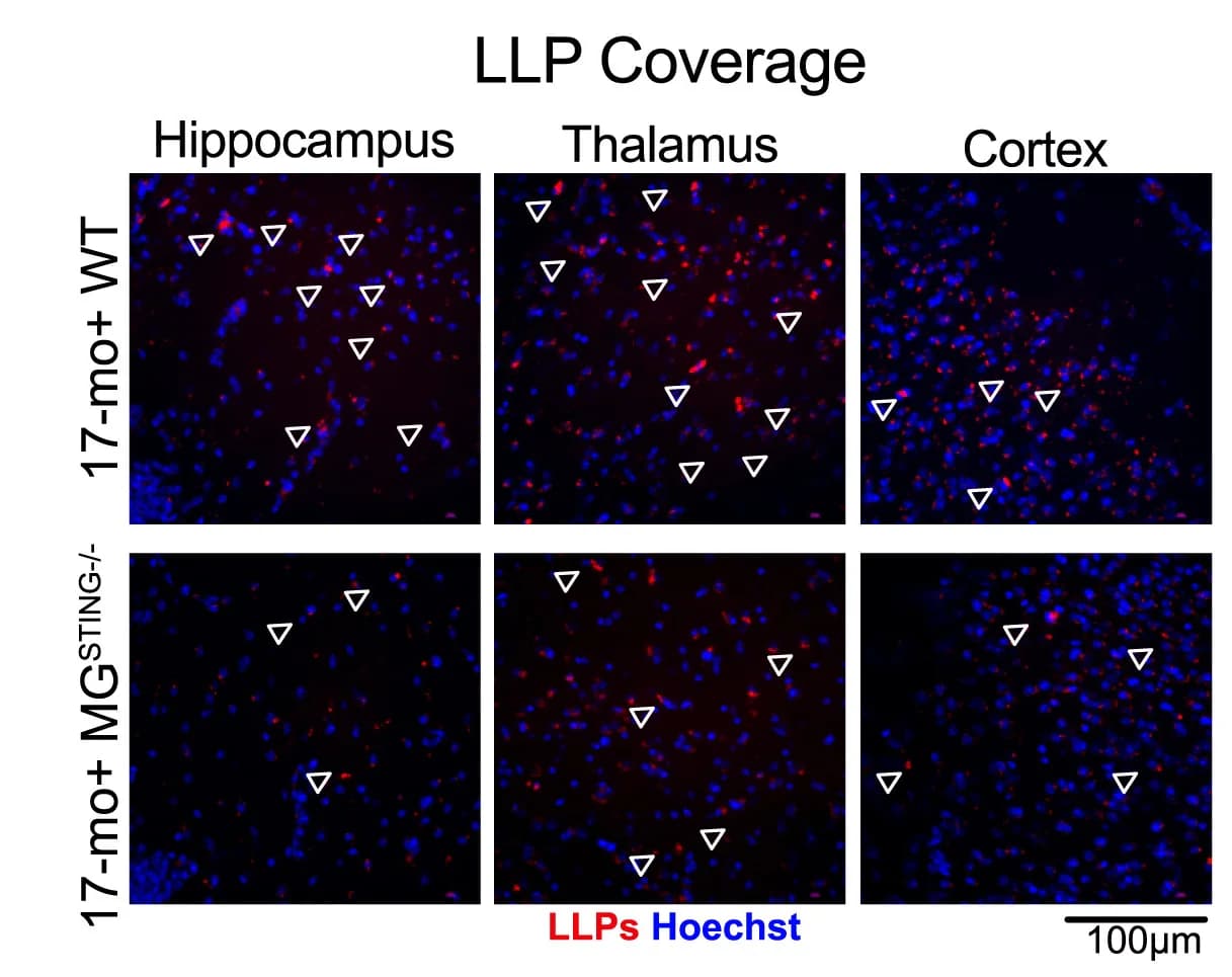 Open access visualization of Microscopy, Lipofuscin-Like Particles, LLPs, Immunofluorescence, Hoechst