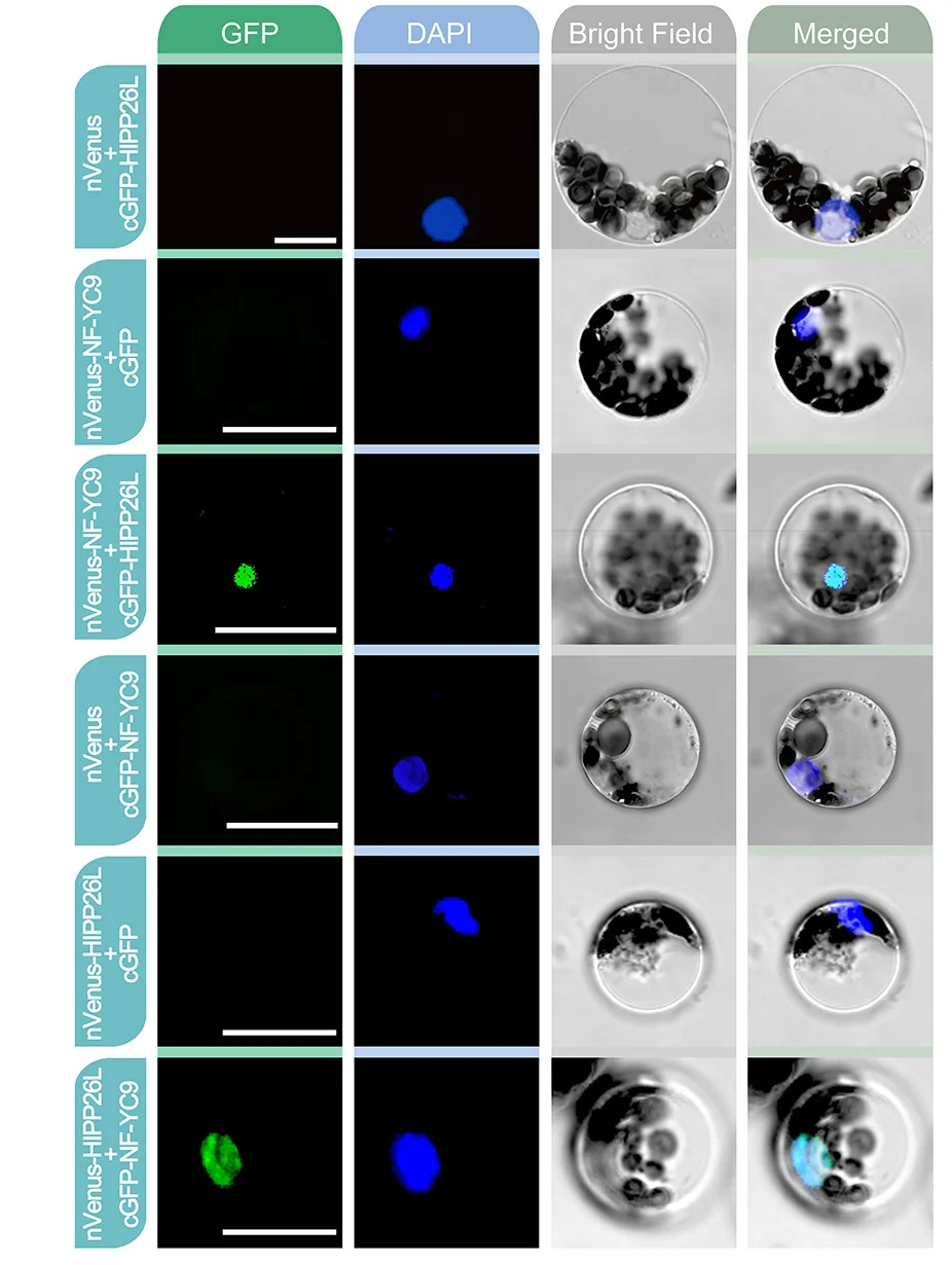 Open access visualization of Microscopy, BiFC Analysis, Poplar Protoplasts, NF-YC9, HIPP26L
