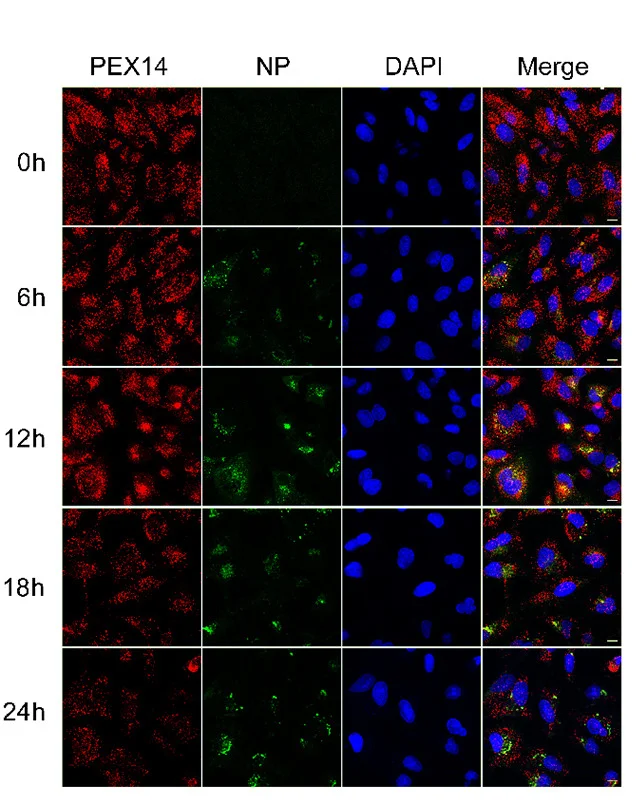 Open access visualization of Microscopy, Immunofluorescence Analysis, NDV-Infected A549 Cells, PEX14