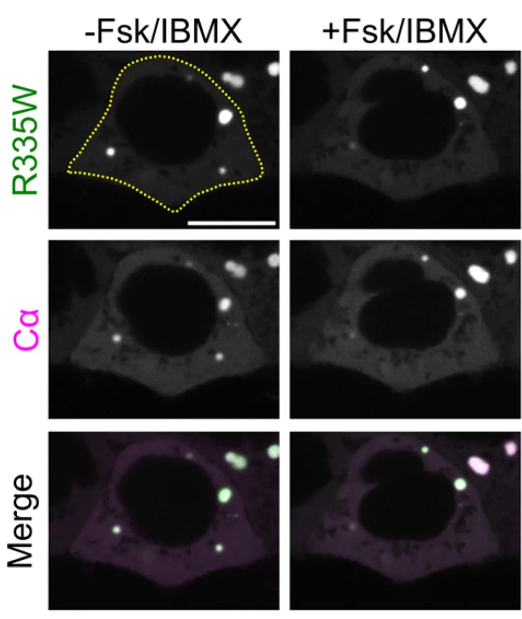 Open access visualization of Microscopy, Cells, RIβR335W-GFP2, Cα-mCherry, cAMP Stimulation