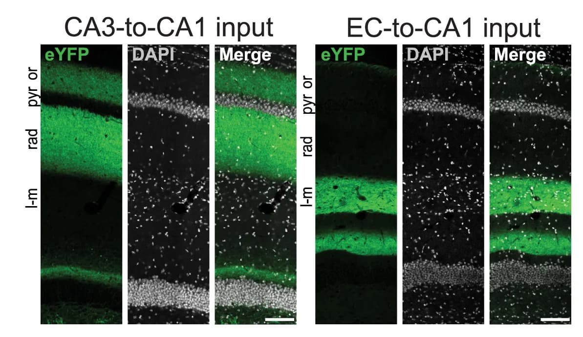 Open access visualization of Microscopy, CA3, CA1 Inputs, Cre-dependent channelrhodopsin-2, ChR2-YFP Vector