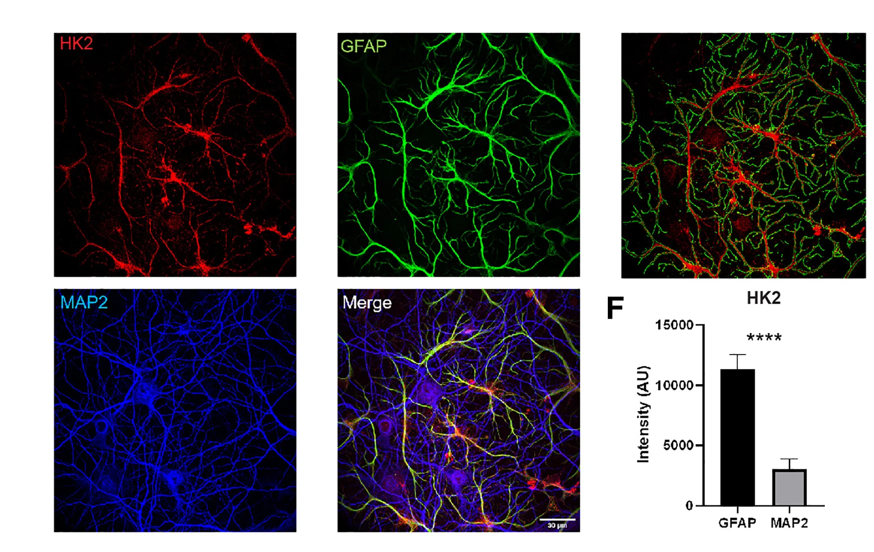 Open access visualization of Microscopy, Bar Plot, Error Bars, Confocal Images, Mouse Cultures