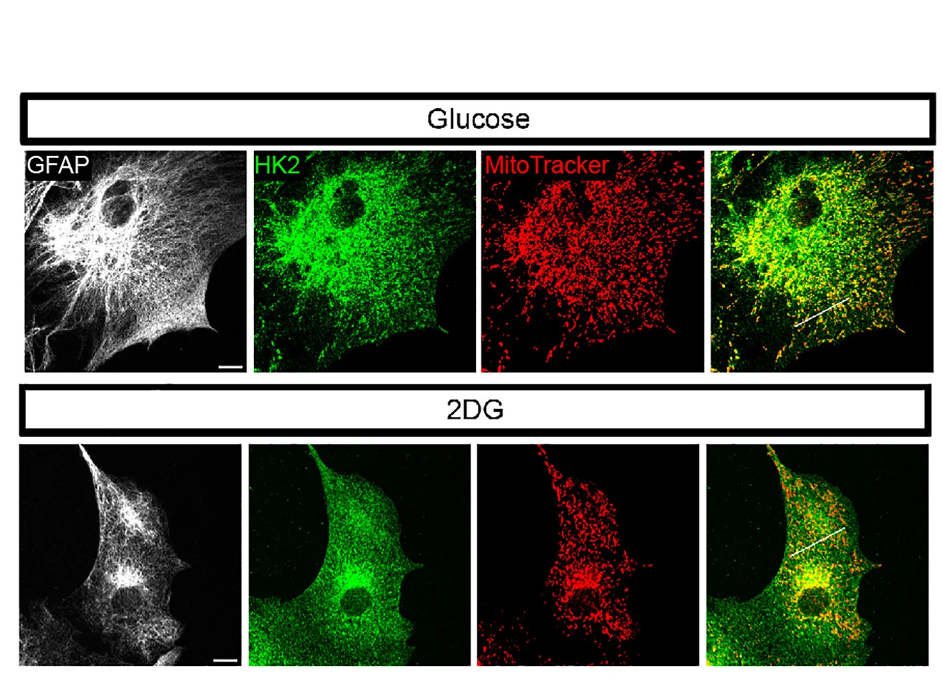 Open access visualization of Microscopy, Confocal Images, Astrocytes, Glucose, 2-DG Medium