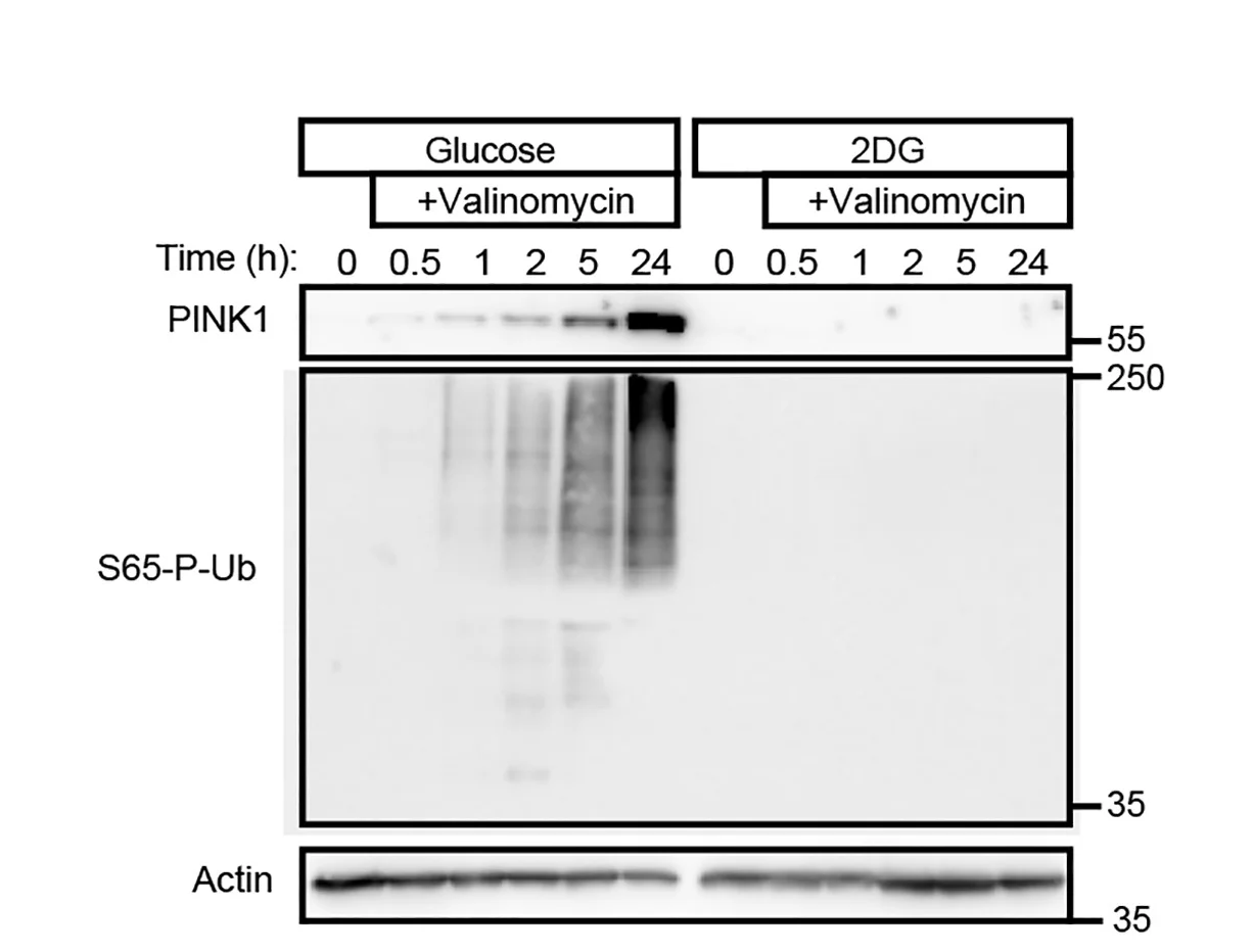 Open access visualization of Gel, Western Blot, Astrocyte Lysates, Glucose, 2-DG Medium