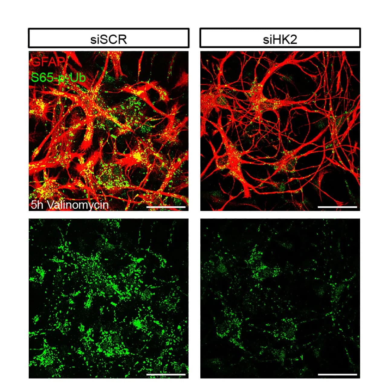 Open access visualization of Microscopy, Confocal Images, Astrocytes, Valinomycin, Immunostaining