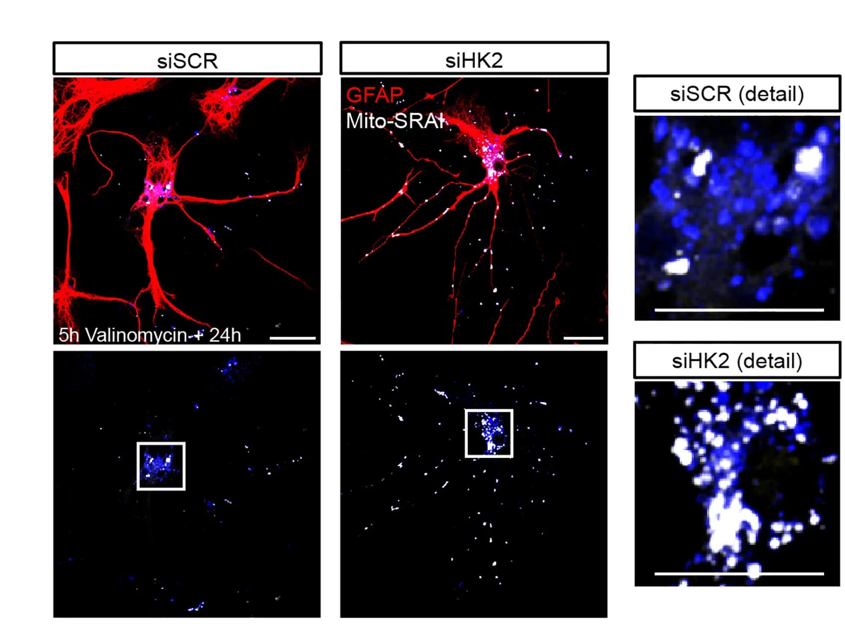 Open access visualization of Microscopy, Confocal Images, Astrocytes, mito-SRAI, Valinomycin