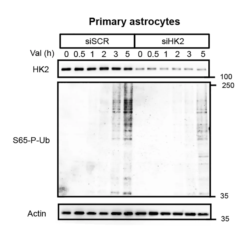 Open access visualization of Gel, Western Blot, Astrocyte Lysates, Valinomycin, HK2