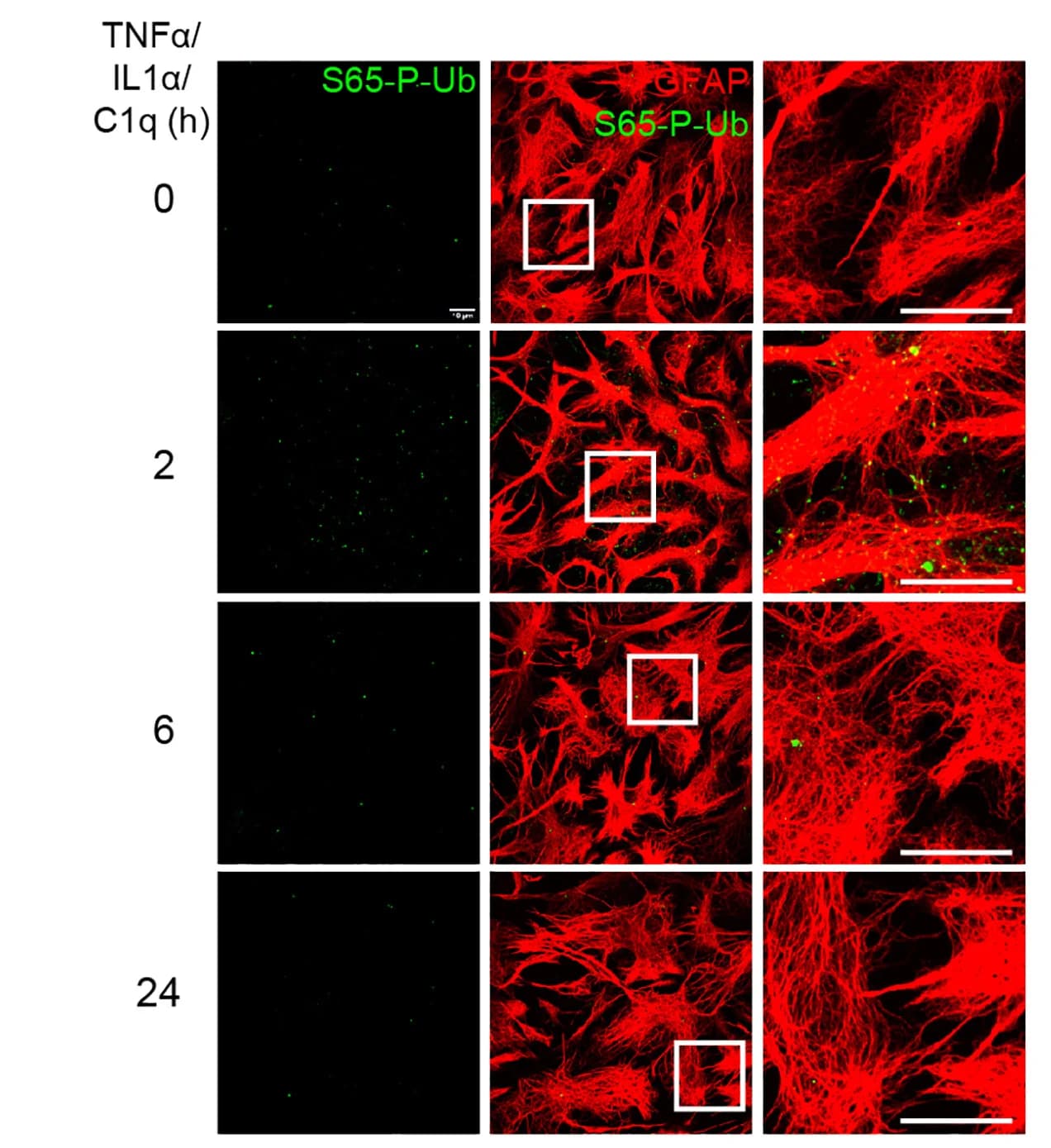 Open access visualization of Microscopy, Confocal Images, Astrocytes, TNF-a, Interleukin-1a