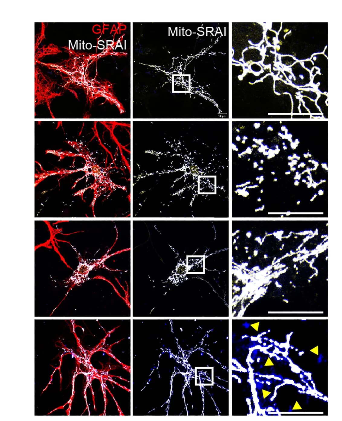 Open access visualization of Microscopy, Confocal Images, Astrocytes, TNF-a, Interleukin-1a