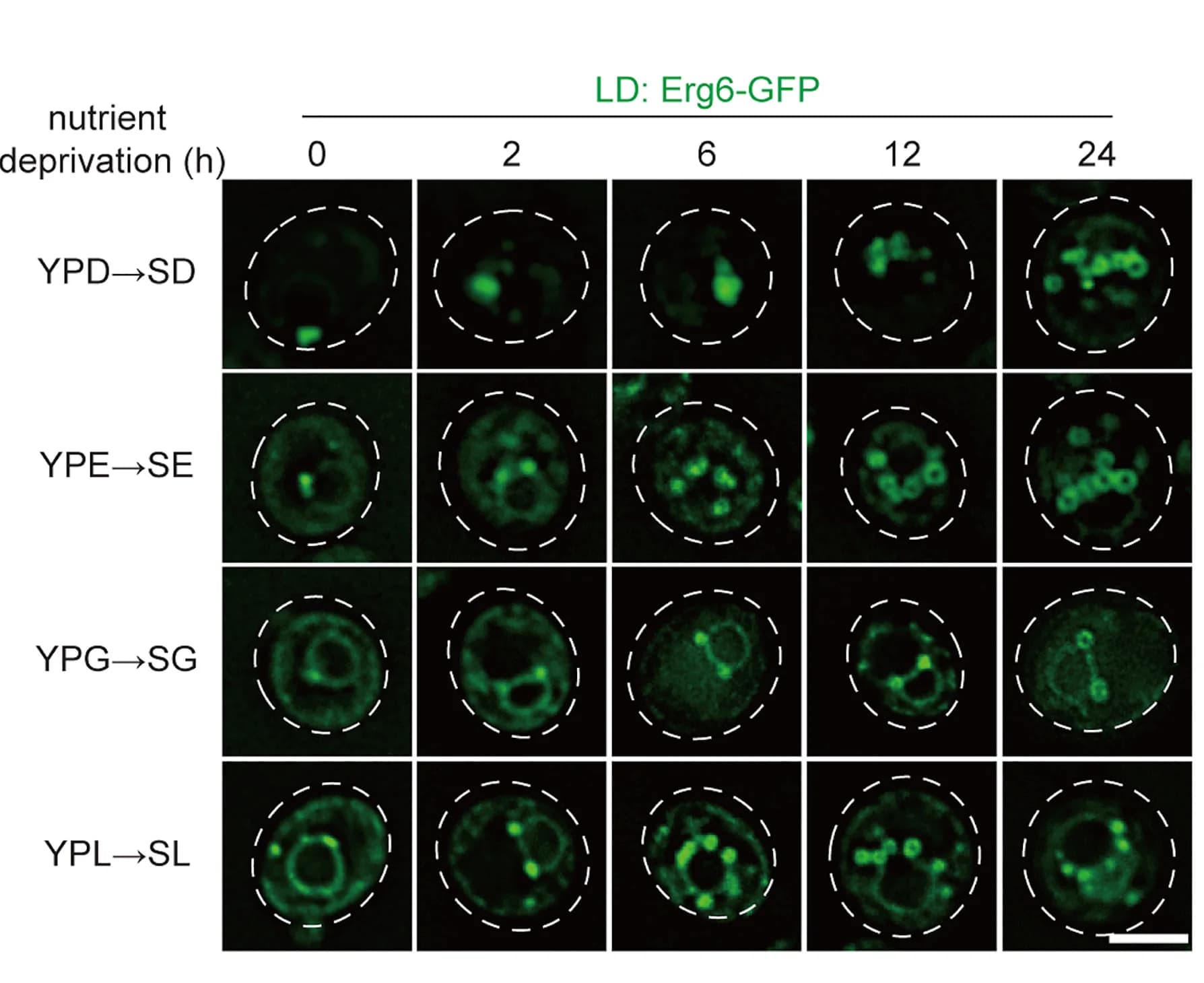 Open access visualization of Microscopy, Live Cell Imaging, Lipid Droplets, Vacuoles, Wild-Type Cells
