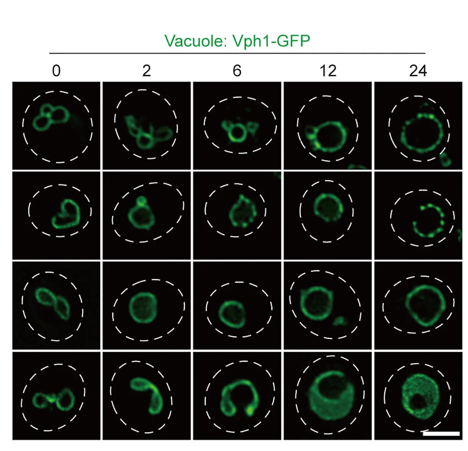 Open access visualization of Microscopy, Live Cell Imaging, Lipid Droplets, Vacuoles, Wild-Type Cells