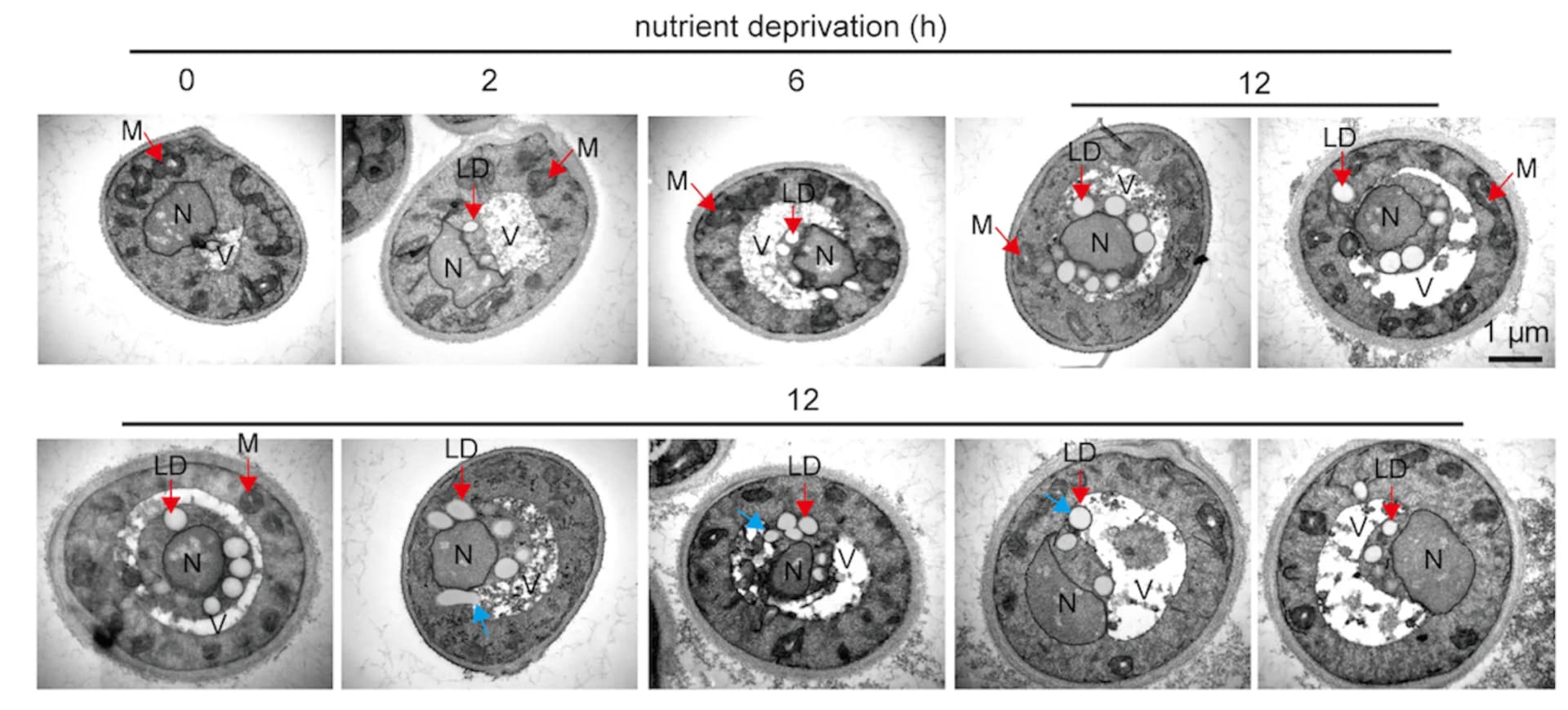 Open access visualization of Microscopy, TEM, Mitochondrion, Nucleus, Vacuole