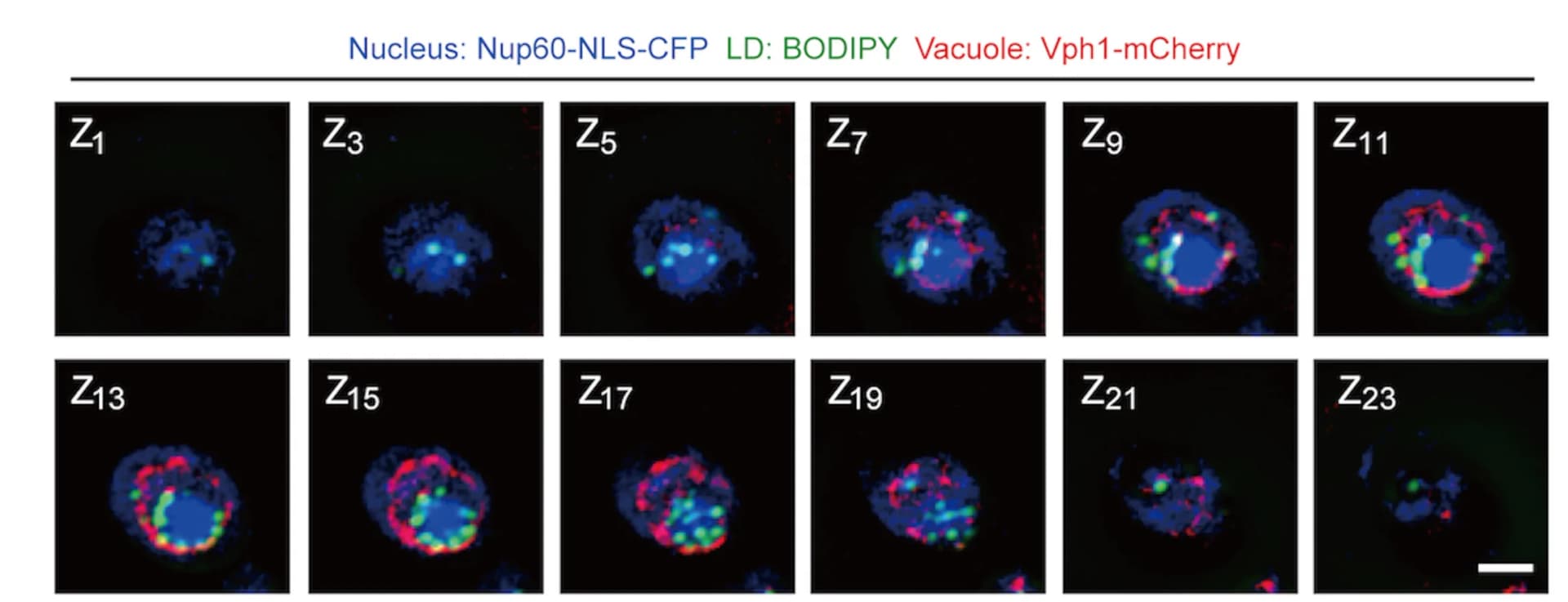 Open access visualization of Microscopy, Confocal Microscopy, WT Cell, Subcellular Bearing, Nucleus