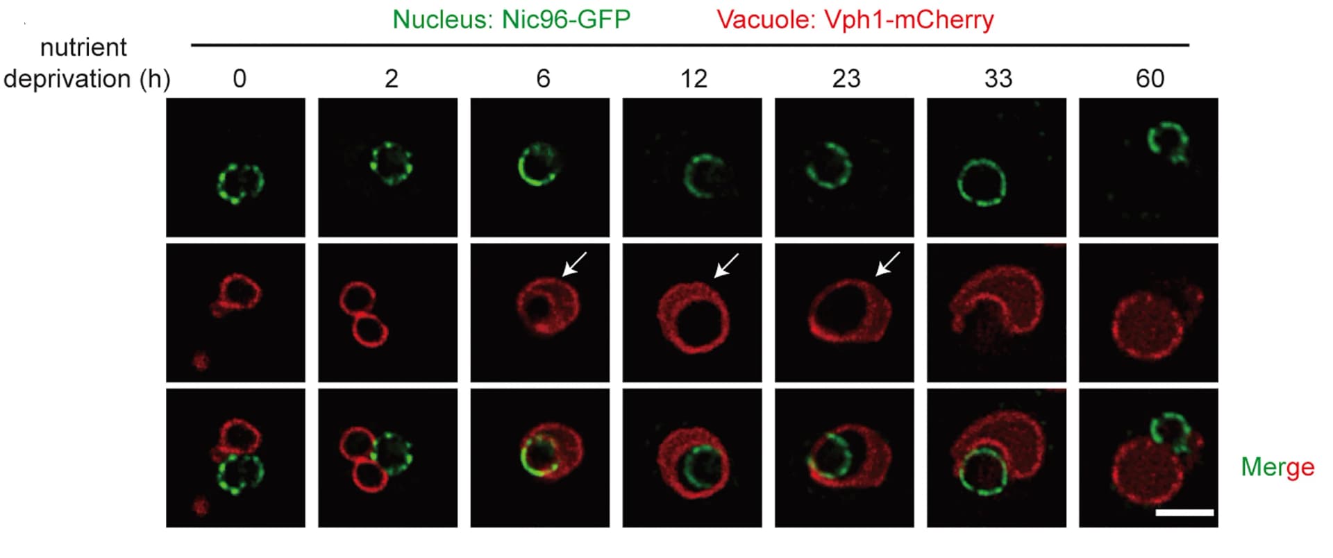 Open access visualization of Microscopy, Fluorescence Imaging, WT Cells, Nucleus, Vacuole