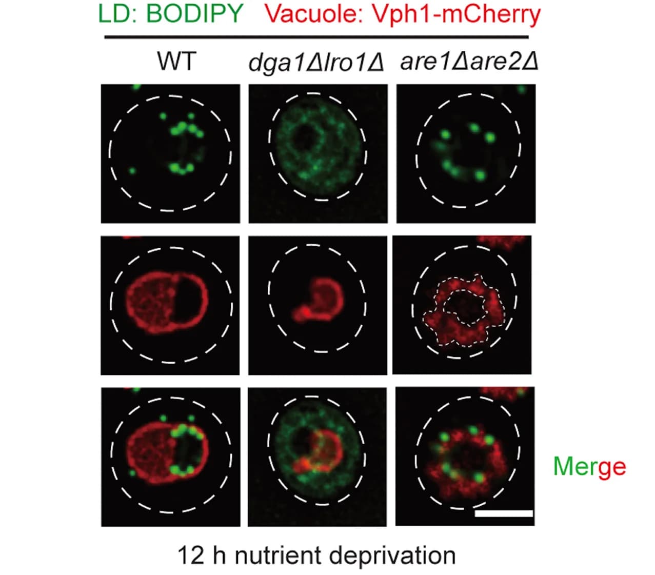 Open access visualization of Microscopy, Live Cell Imaging, Vph1-mCherry, Vacuoles, BODIPY