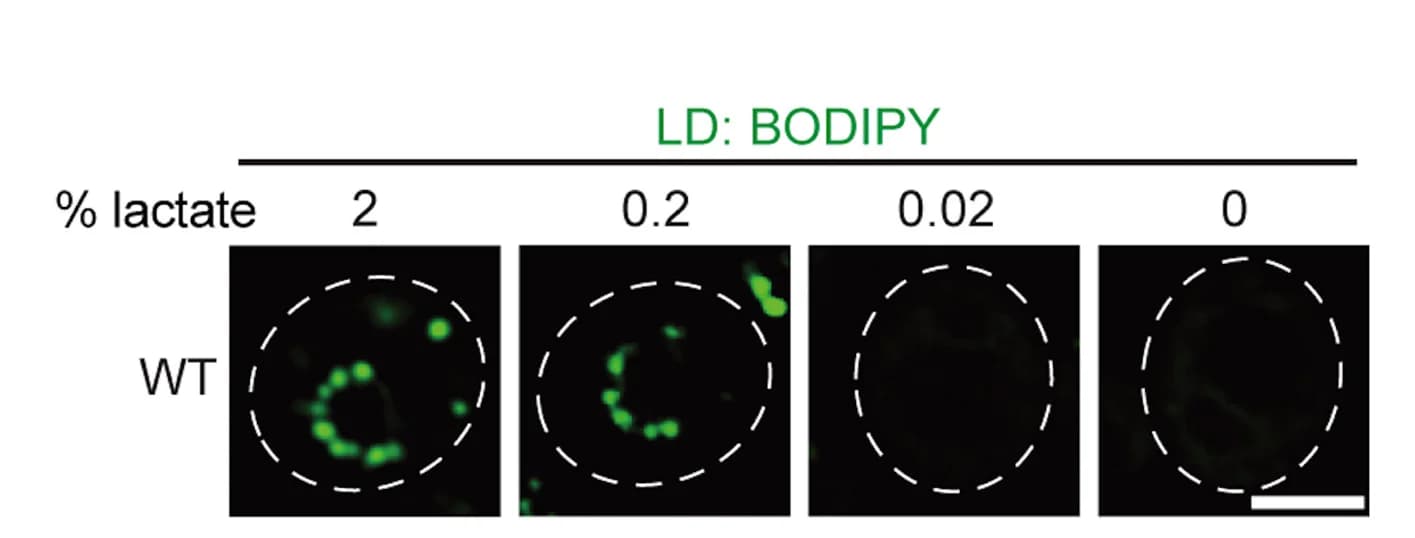 Open access visualization of Microscopy, BODIPY Staining, Lipid Droplets, WT Cells, Nutrient Deprivation