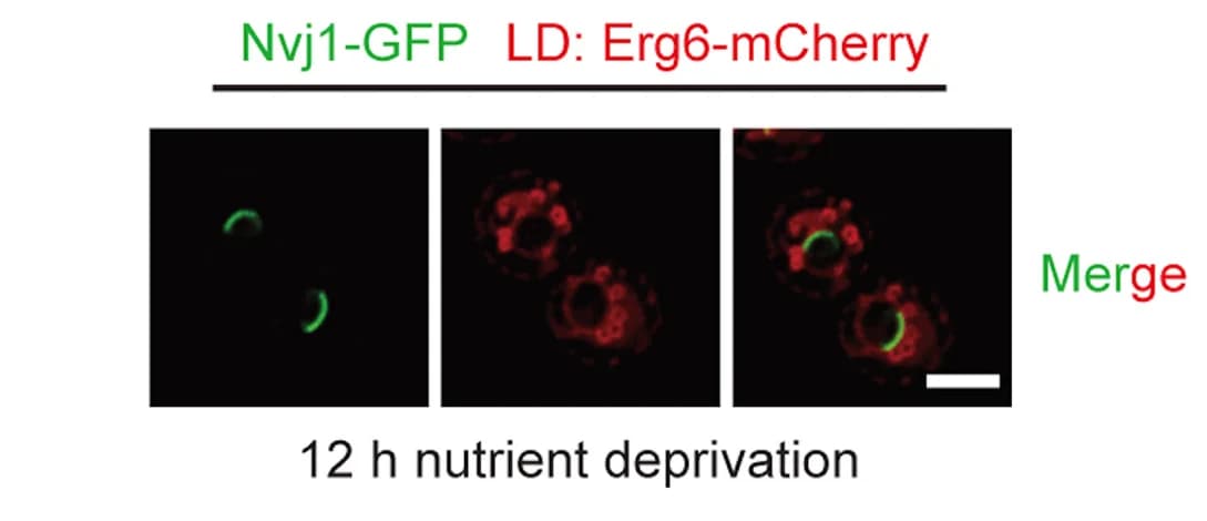 Open access visualization of Microscopy, Live Cell Imaging, NVJ, LDs, WT Cells