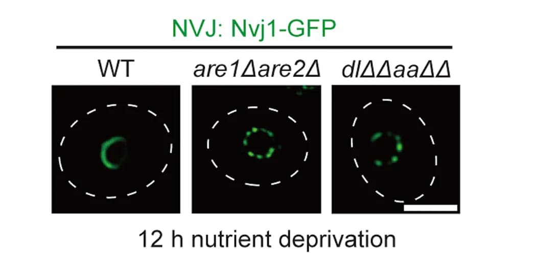 Open access visualization of Microscopy, Live Cell Imaging, NVJ, Nutrient Deprivation, Nvj1-GFP