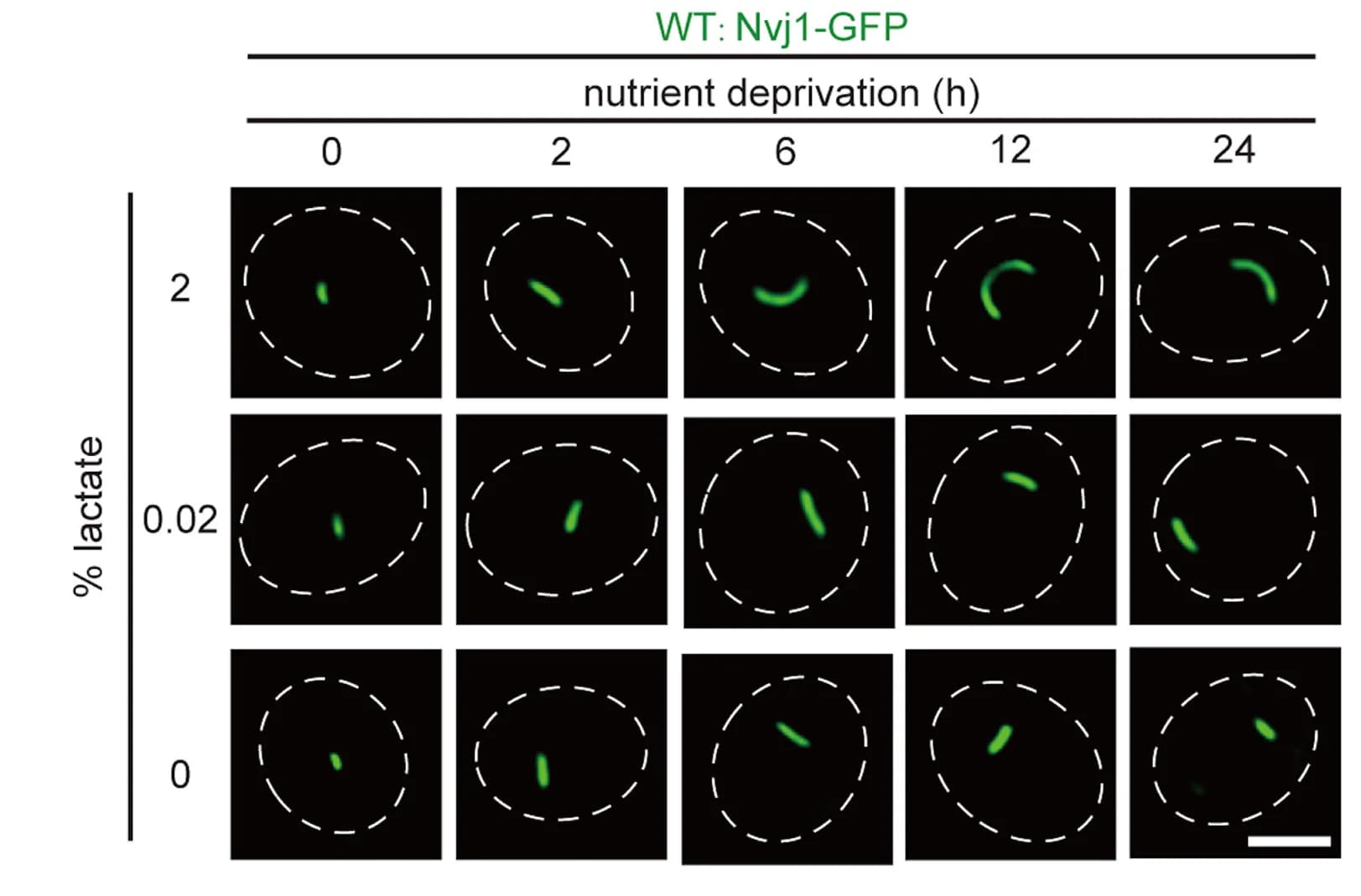 Open access visualization of Microscopy, Live Cell Imaging, NVJ, WT Cells, Nutrient Deprivation