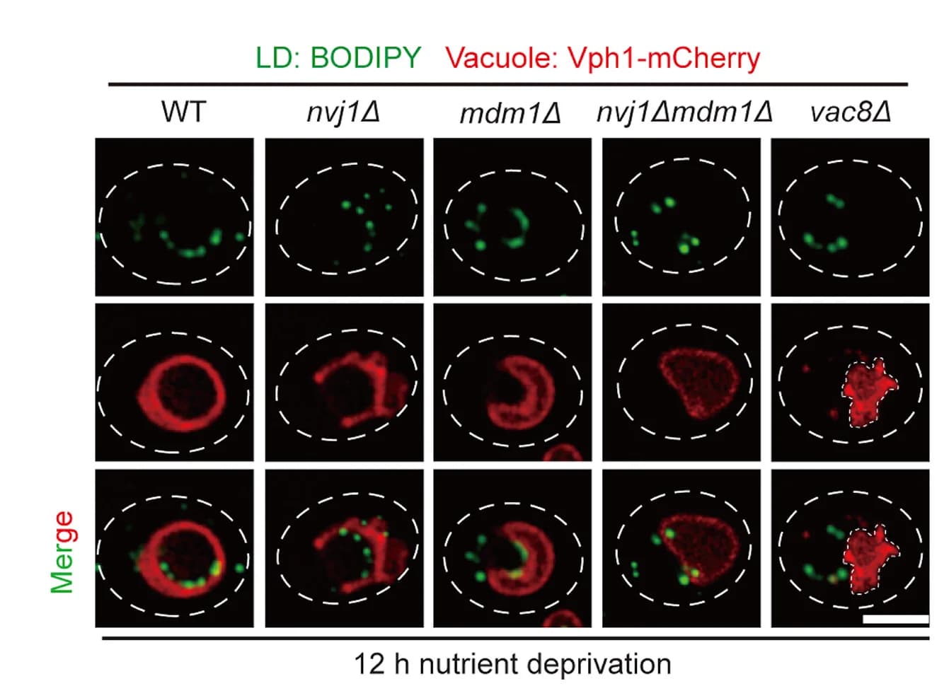 Open access visualization of Microscopy, Live Cell Imaging, Lipid Droplets, Vacuole, Nutrient Deprivation