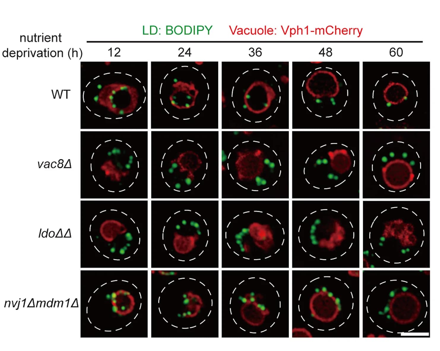 Open access visualization of Microscopy, Live Cell Imaging, Lipid Droplets, Vacuole