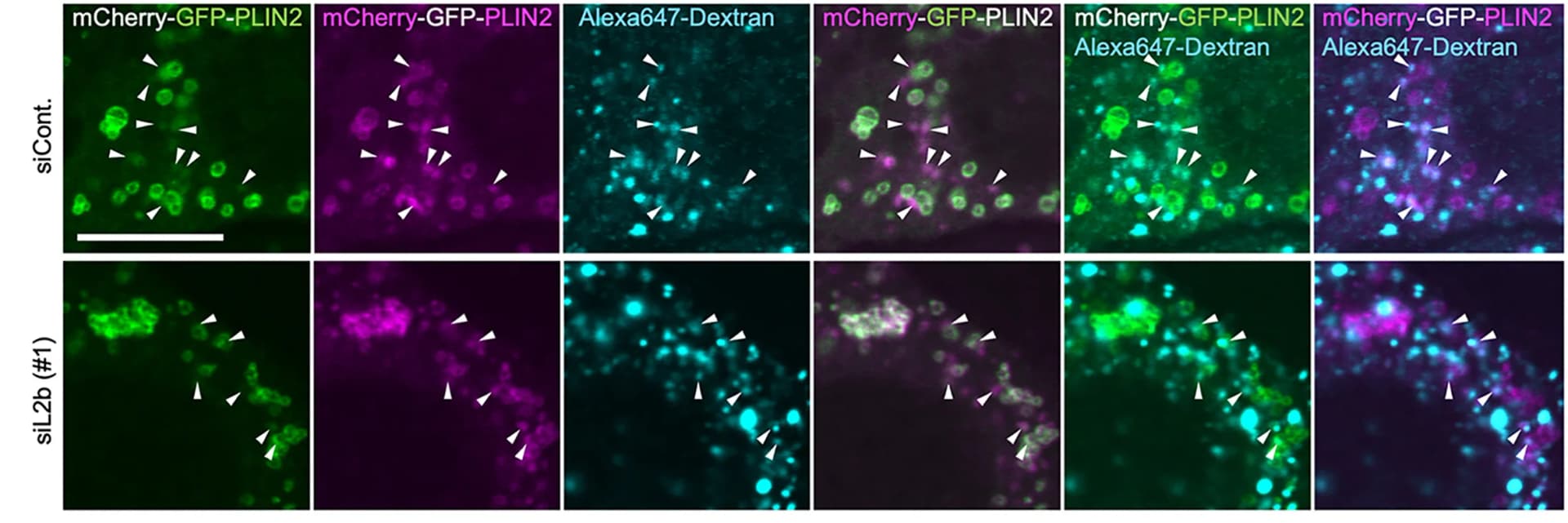 Open access visualization of Microscopy, Cellular Localization, mCherry-GFP-PLIN2, Alexa 647-Dextran, AML12 Cells