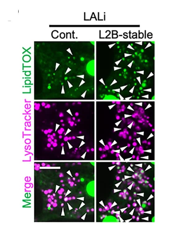Open access visualization of Microscopy, Manders’ Correlation Coefficient, GFP, mCherry-PLIN2, Alexa 647-Dextran