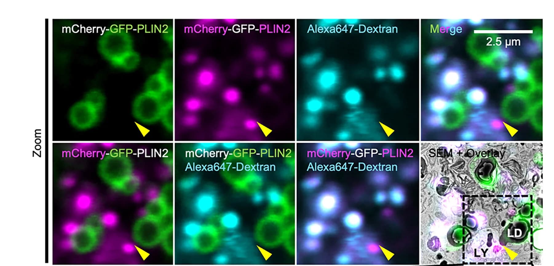 Open access visualization of Microscopy, Photo, CLEM Images, AML12 Cells, mCherry-GFP-PLIN2