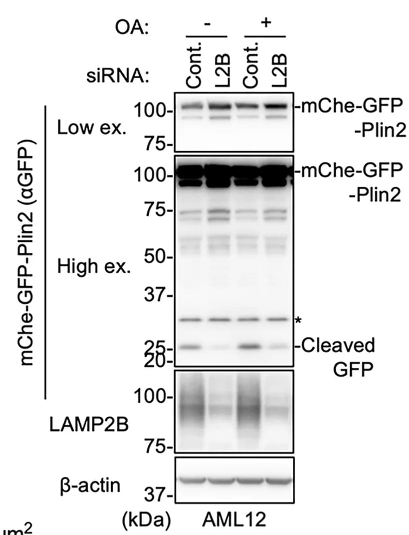 Open access visualization of Gel, Reporter Processing Assay, AML12 Cells, mCherry-GFP-PLIN2, Lamp2b Knockdown