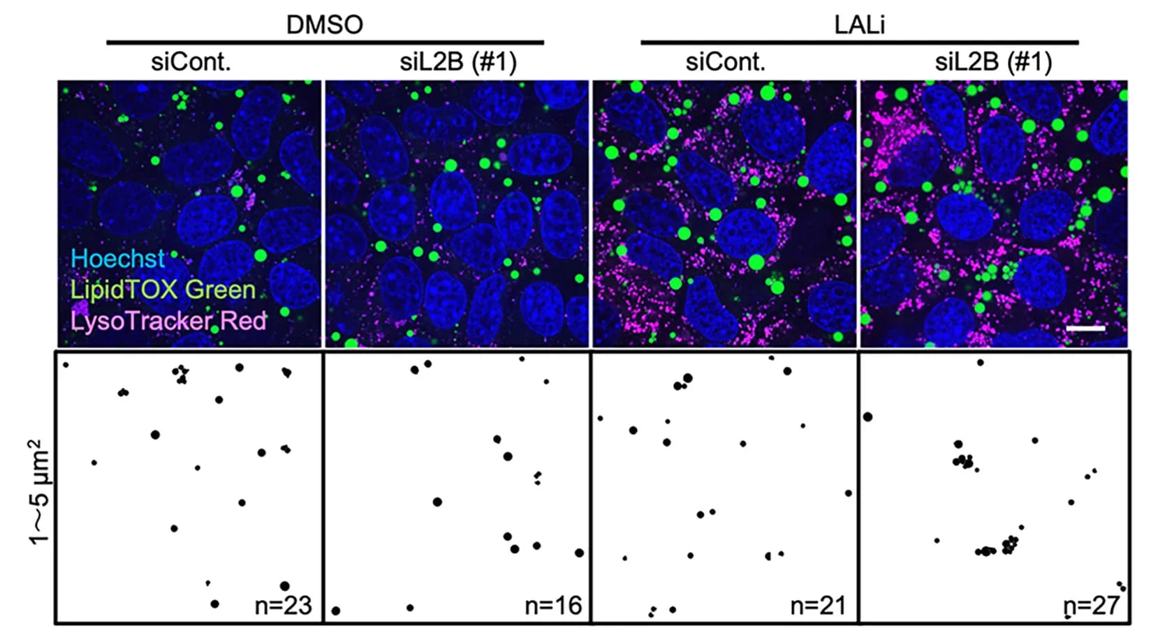 Open access visualization of Microscopy, Scatter Plot, LD Levels, LAMP2B-KD, AML12 Cells