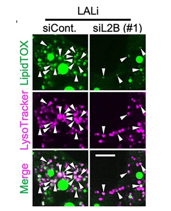 Open access visualization of Microscopy, Cellular Localization, LipidTOX, LysoTracker, LAMP2B-KD