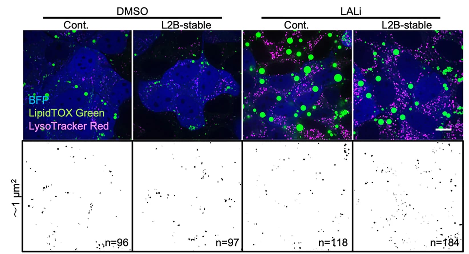 Open access visualization of Microscopy, LD Levels, LAMP2B-KD, AML12 Cells, LALi