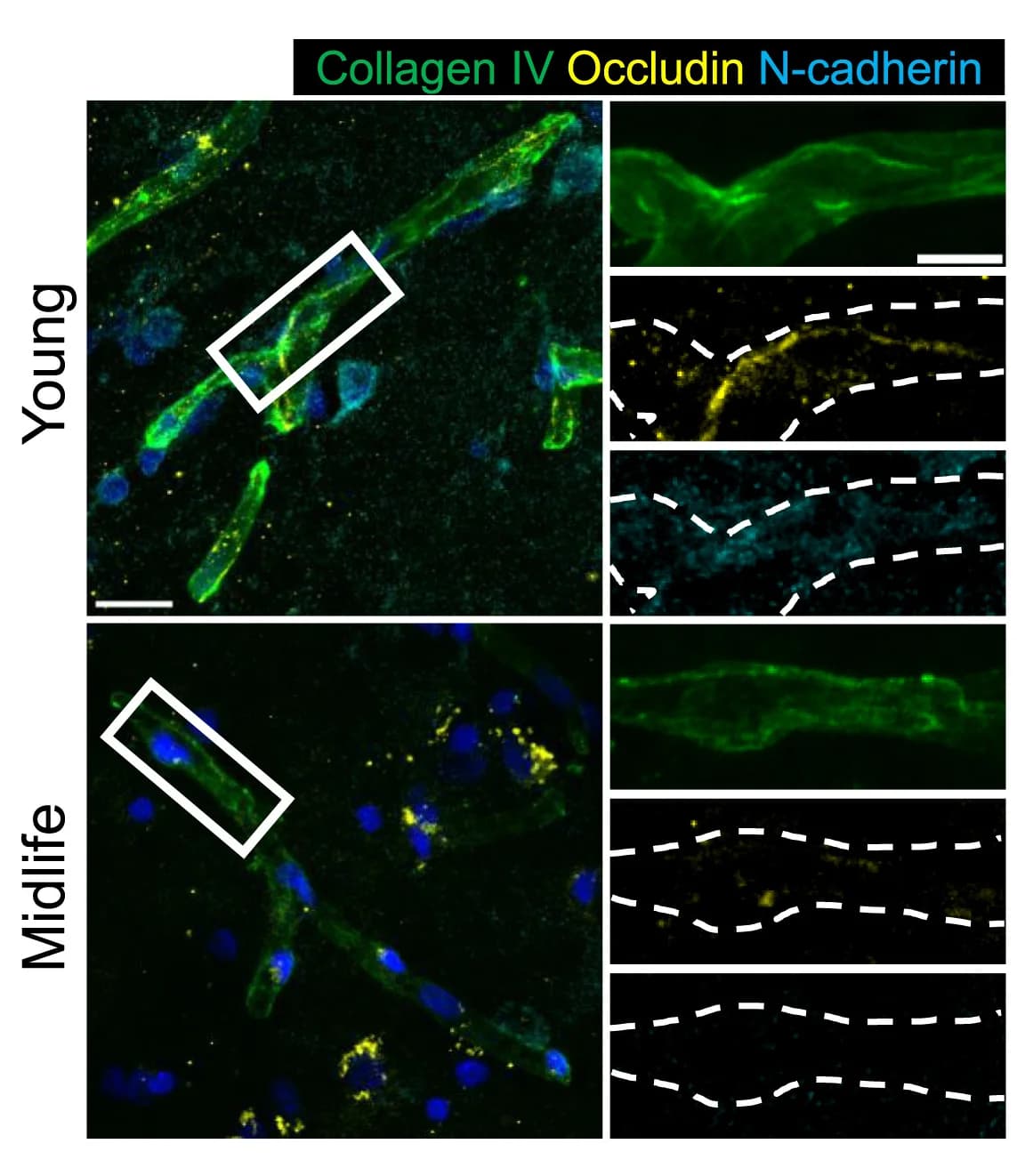 Open access visualization of Microscopy, Immunofluorescent Staining, Cortex Tissues, Occludin, Collagen IV