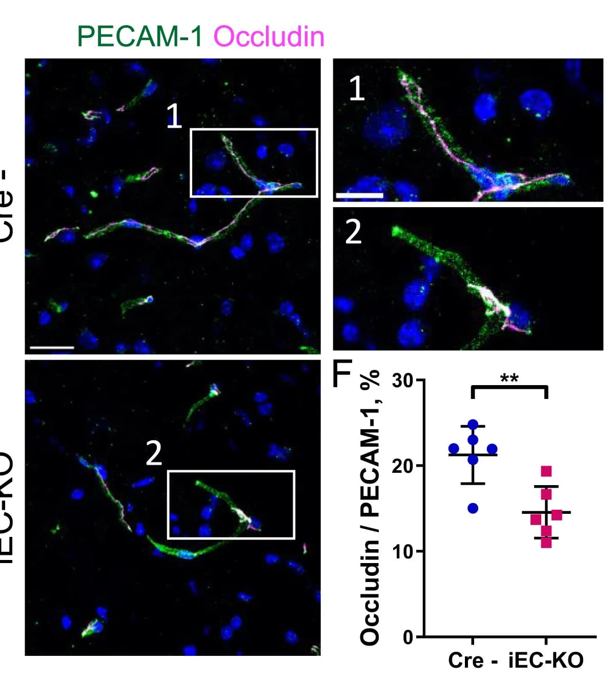Open access visualization of Microscopy, Scatter Plot, Error Bars, Occludin, PECAM1
