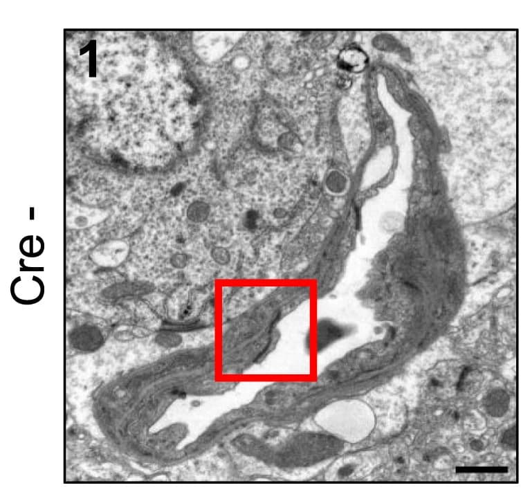 Open access visualization of Microscopy, Transmission Electron Microscopy, Brain Tissue, N-cadherin, iEC-KO Mice