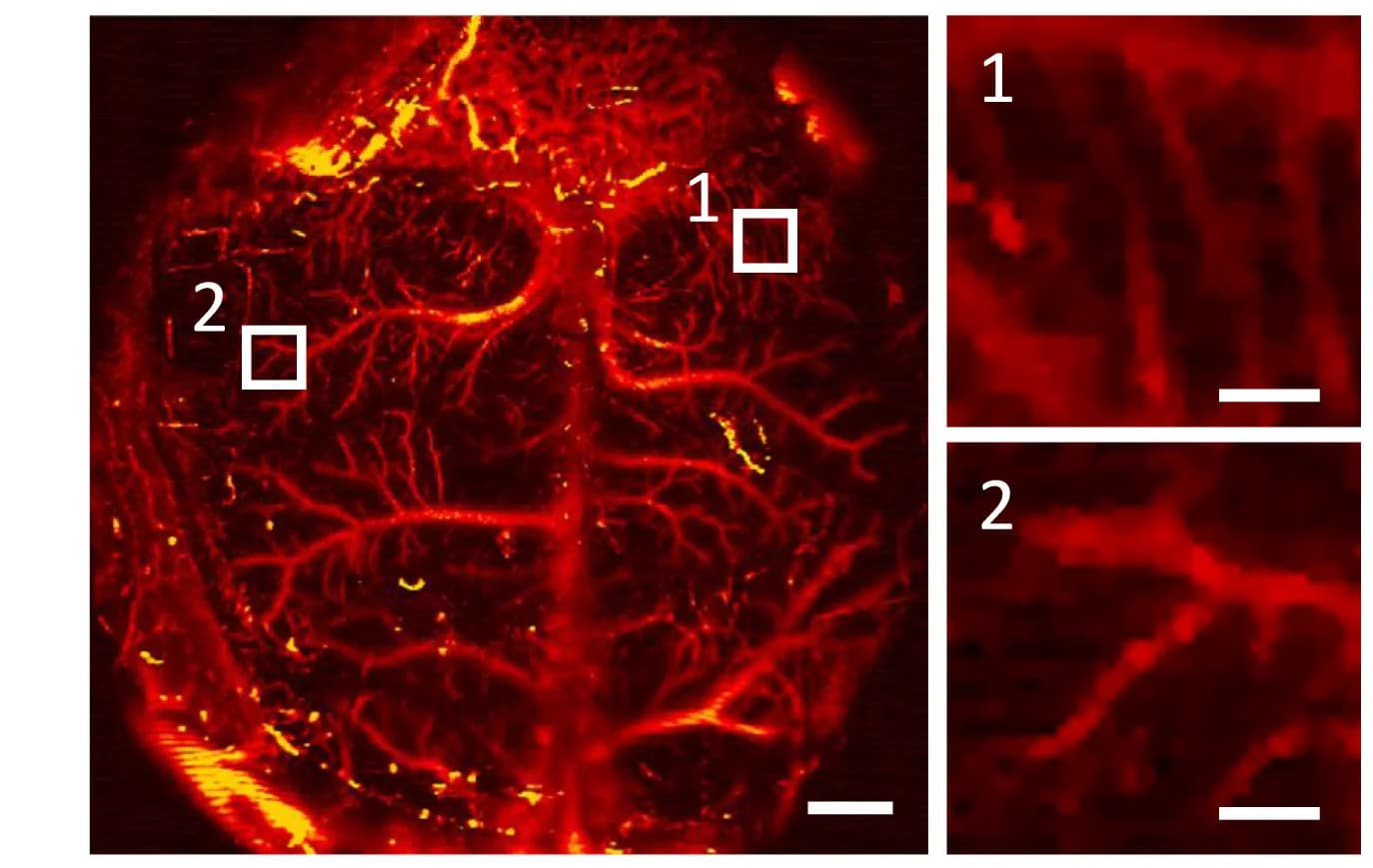 Open access visualization of Microscopy, Brain Vasculature, Photoacoustic Microscopy, Mice