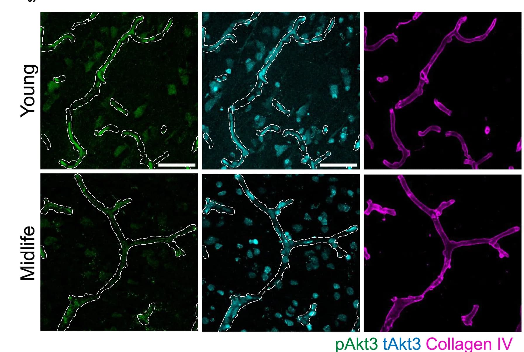 Open access visualization of Microscopy, Immunofluorescent Staining, Human Cortex Tissues, pAkt3, Total Akt3